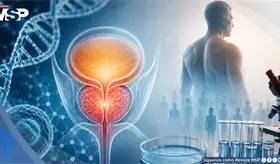 C&aacute;ncer de pr&oacute;stata en Puerto Rico: una disparidad que sigue en espera de respuestas