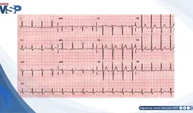 Manejo de Hipertensi&oacute;n Arterial Esencial Grado 2 en un Paciente con Riesgo Cardiovascular Moderado