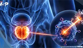 C&aacute;ncer de pr&oacute;stata en Puerto Rico: una enfermedad que sigue marcando la salud de los hombres
