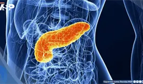 Quistes pancre&aacute;ticos permiten estimar el riesgo de c&aacute;ncer seg&uacute;n sus caracter&iacute;sticas