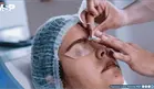 Trasplantan por primera vez mitocondrias sanas en los ojos de una mujer ciega