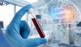 FDA autoriza prueba de sangre de Roche y Lilly para detectar indicios de alzhéimer