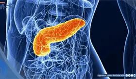 C&aacute;ncer de p&aacute;ncreas: FDA aprueba p&iacute;ldora que revoluciona el tratamiento contra esta enfermedad