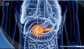 Pancreatitis aguda biliar : Dolor abdominal agudo y evoluci&oacute;n cl&iacute;nica complicada en una paciente joven