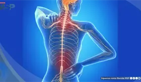 La esclerosis m&uacute;ltiple, enfermedad neurodegenerativa cr&oacute;nica del sistema nervioso central