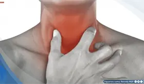 Esofagitis por reflujo gastroesof&aacute;gico: presentaci&oacute;n de un caso cl&iacute;nico