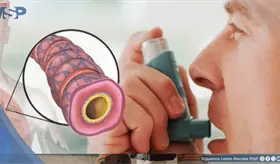 Exacerbaci&oacute;n aguda de asma bronquial desencadenada por infecci&oacute;n respiratoria