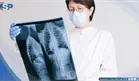 EPOC: la enfermedad pulmonar que puede avanzar durante a&ntilde;os sin ser detectada