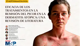 Eficacia de los tratamientos en la remisi&oacute;n del picor en la dermatitis at&oacute;pica