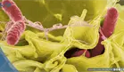 Klebsiella pneumoniae y Candida albicans, microorganismos relacionados con la muerte de ocho beb&eacute;s