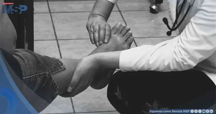 Caso Cl&iacute;nico: Edema de miembros inferiores