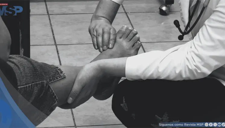 Caso Clínico: Edema de miembros inferiores Caso Clínico: Edema de miembros inferiores