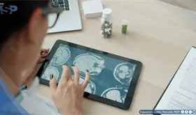 Interfaz cerebral combina habla y gestos en personas con parálisis