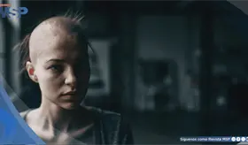 La alopecia prematura en j&oacute;venes se vincula con alteraciones metab&oacute;licas