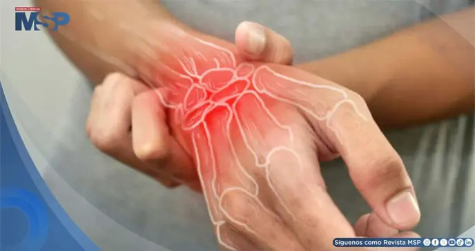 Osteoporosis en hombres puertorrique&ntilde;os: la amenaza que se diagnostica demasiado tarde