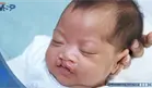 Labio y paladar fisurado en Puerto Rico: datos epidemiol&oacute;gicos y su abordaje multidisciplinario